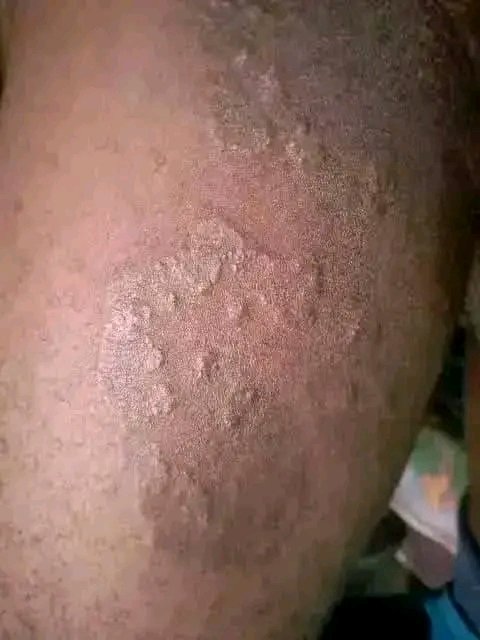 Tradi thérapeutique