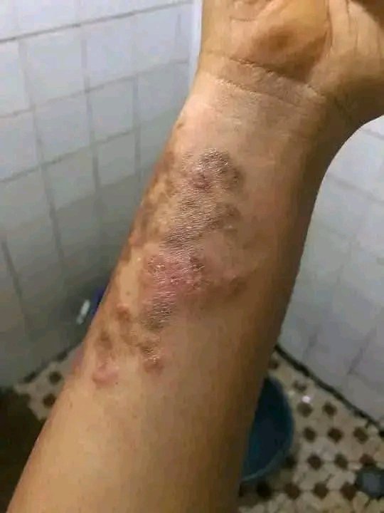 Tradi thérapeutique