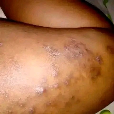 Tradi thérapeutique